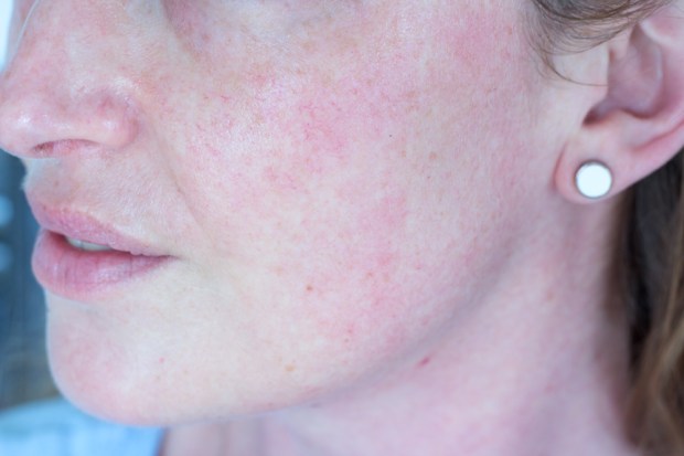 Masque Dr Jart Sephora Avis